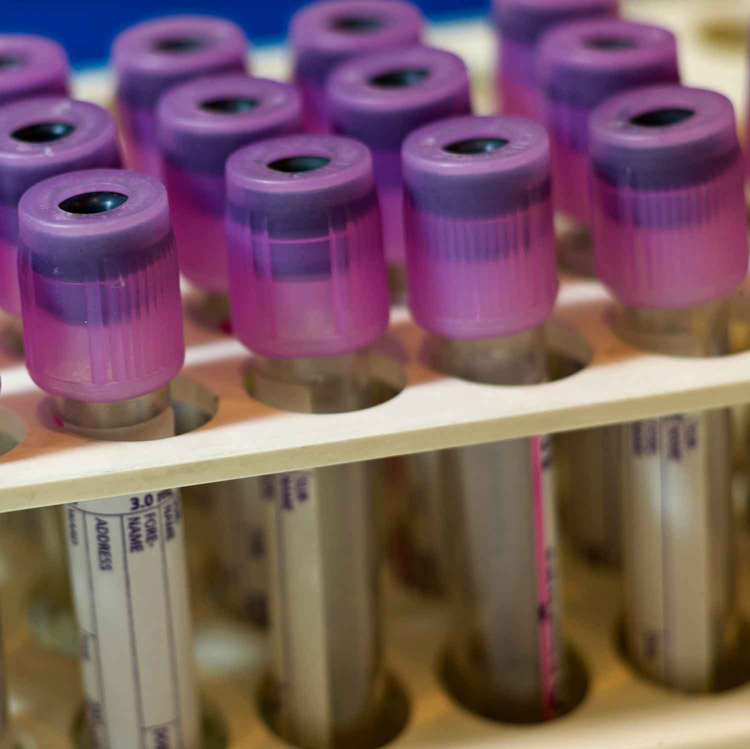 Image of test tubes placeholder image.